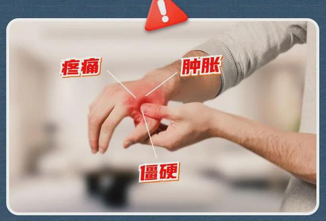 、手麻、腱鞘问题推荐用它！球盟会小米生态杀疯了！手酸(图13)